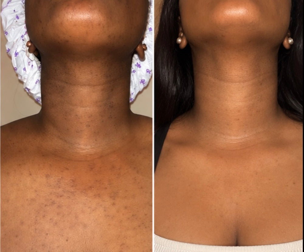<p><strong>THE CONFIDENCE OF FEELING GOOD IN YOUR SKIN.</strong></p><p></p>