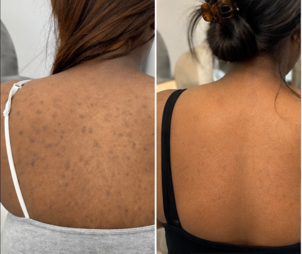 <p><strong>THE CONFIDENCE OF FEELING GOOD IN YOUR SKIN.</strong></p><p></p>