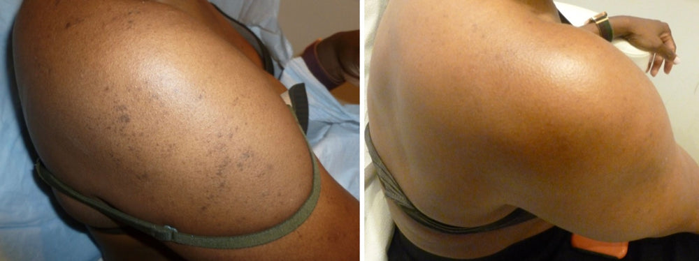<p><strong>THE CONFIDENCE OF FEELING GOOD IN YOUR SKIN.</strong></p><p></p>