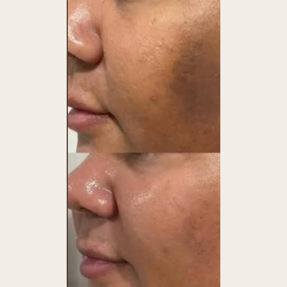 <p><strong>THE CONFIDENCE OF FEELING GOOD IN YOUR SKIN.</strong></p><p></p>